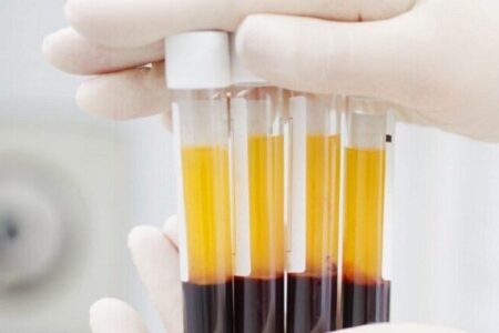 ایران تا ۲ سال آینده جزو ۱۰ کشور دنیا در تولید پلاسما خواهد بود