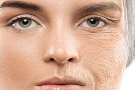 ۵ ماده غذایی که بیشتر از آفتاب برای پوست ضرر دارد