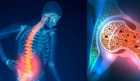 ۵۰ تا ۷۰ درصد زنان کمبود ویتامین D دارند