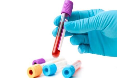 شناسایی یک گروه خونی نادر در استان کرمان