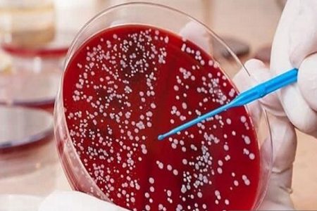 تومورهای ثانویه پس از درمان سرطان خون با ایمونوتراپی نادر هستند