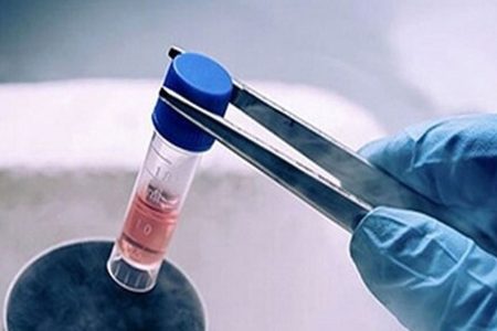 کیت ژنتیک ۳۲ جایگاهی تا ۲ هفته آینده رونمایی می‌شود