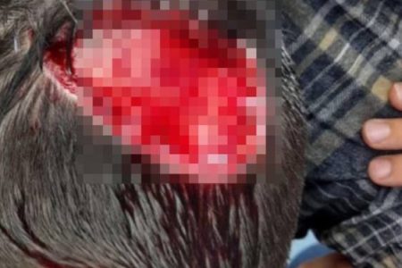 حمله سگ‌های ولگرد به پسربچه ۸ ساله در شهر سهند!