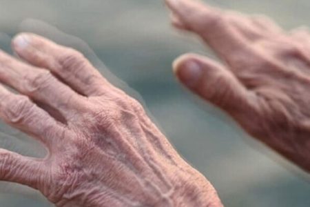 اضطراب عامل ابتلا به پارکینسون است؟